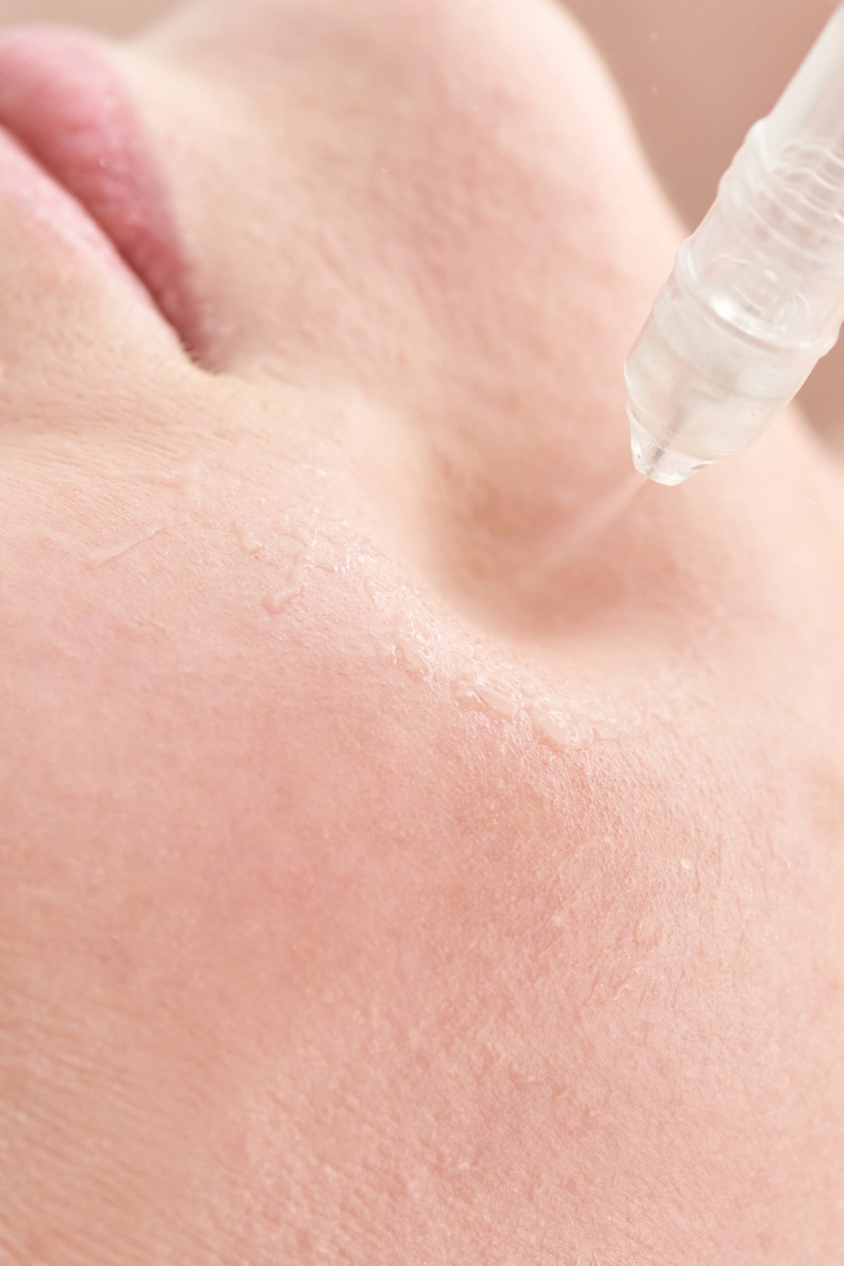Numbing Cream for Dermaplaning & Microneedling