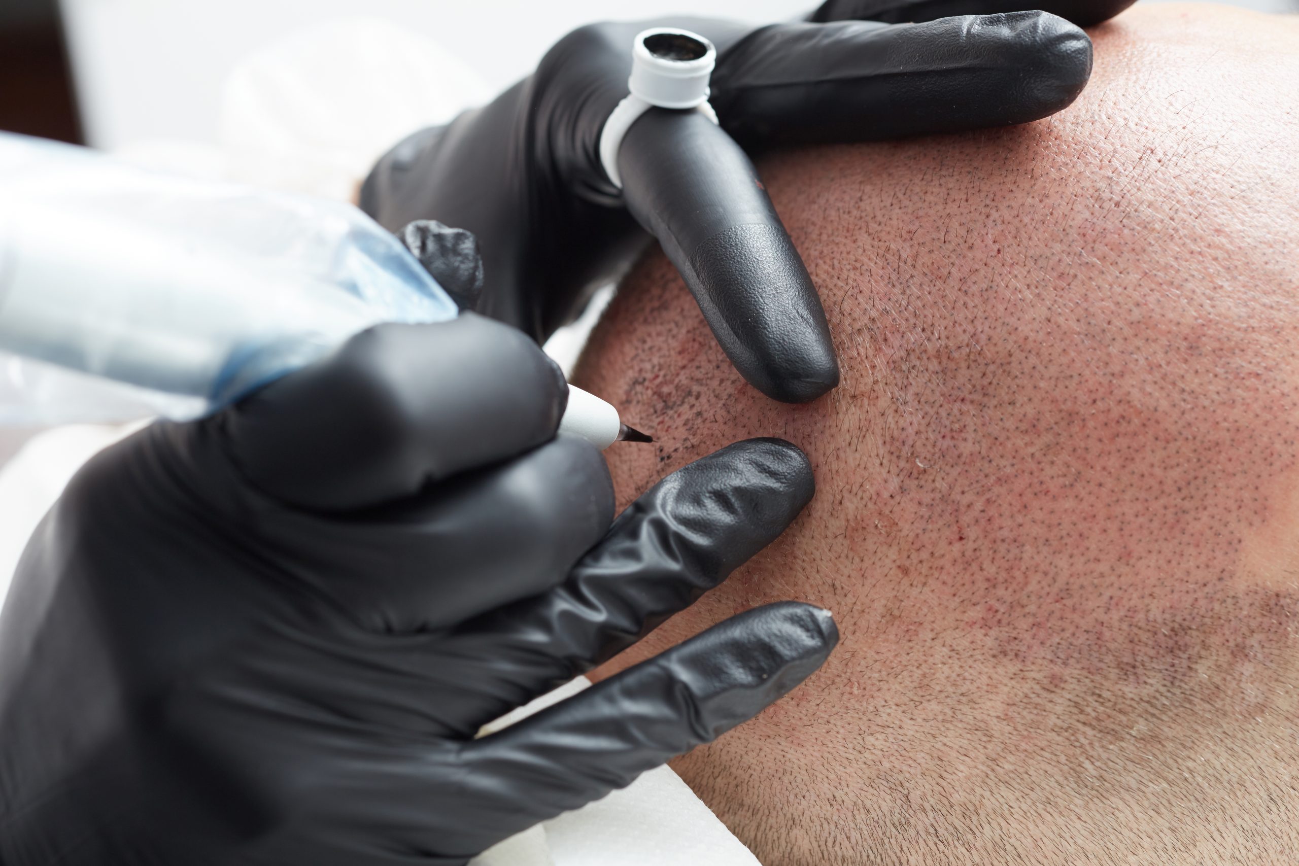 Best Numbing Cream for Cosmetic Tattooing